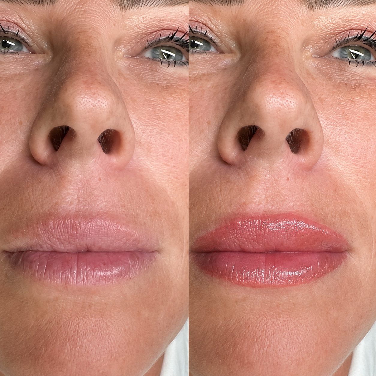 Before and after close up showing a soft, naturally enhanced lip blush result